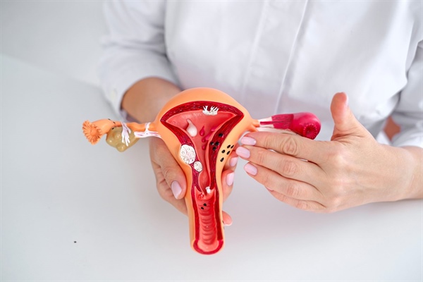 Uterine Fibroids: The Common Condition You Need to Know About